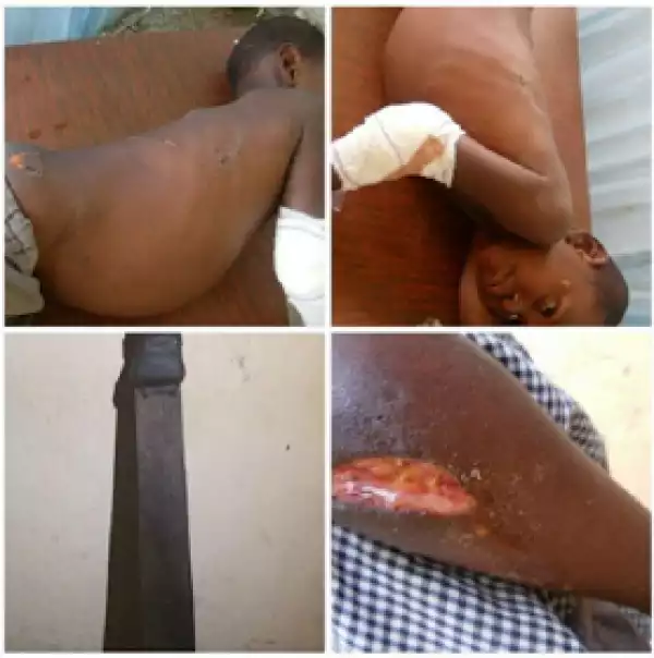 6 year-old boy brutalized with a machete by his stepfather for buying him bread instead cigarette
